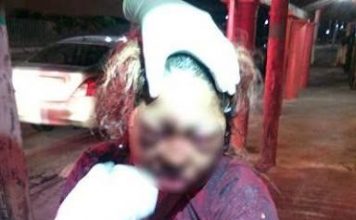 Golpean a mujer en Tuxpan; le abrieron la cabeza