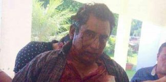 Regresan ensangrentado al candidato de Morena en Chicontepec